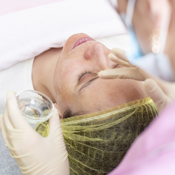 A professional cosmetologist applies a chemical peeling solution to the patient on the skin of the face with the help of hands in gloves. Close-up.